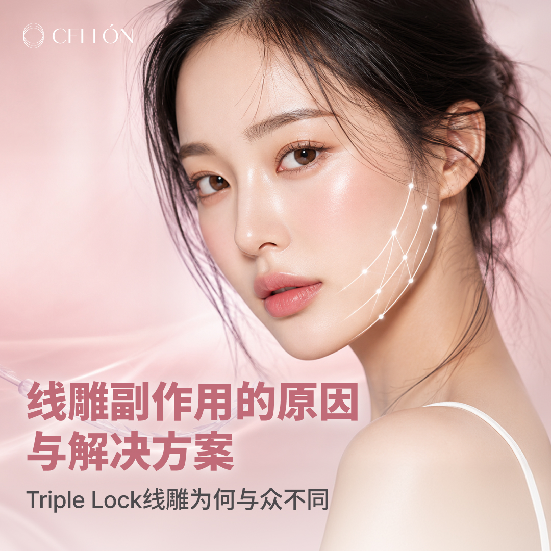 中文 발행 이미지