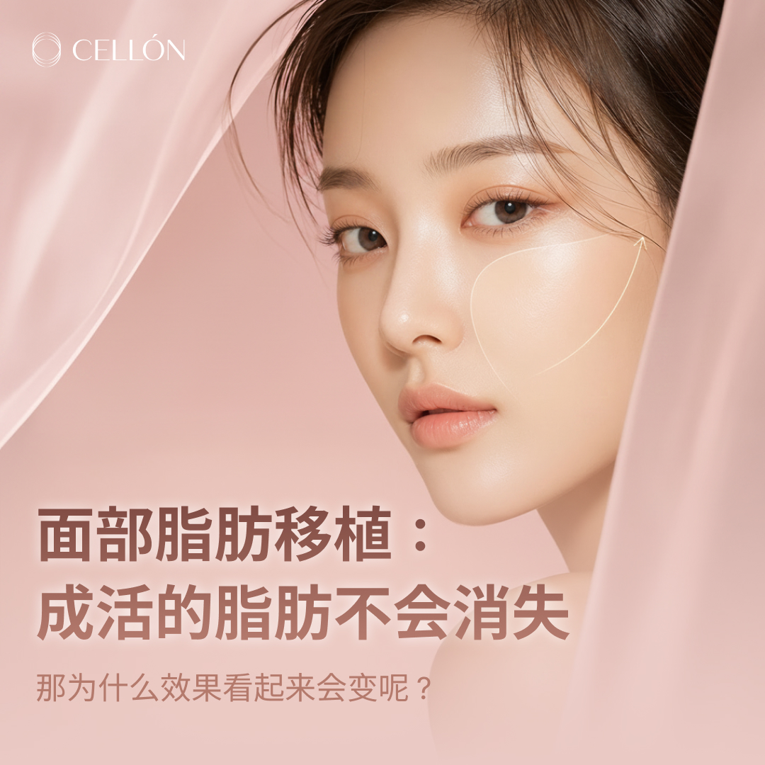 中文 발행 이미지
