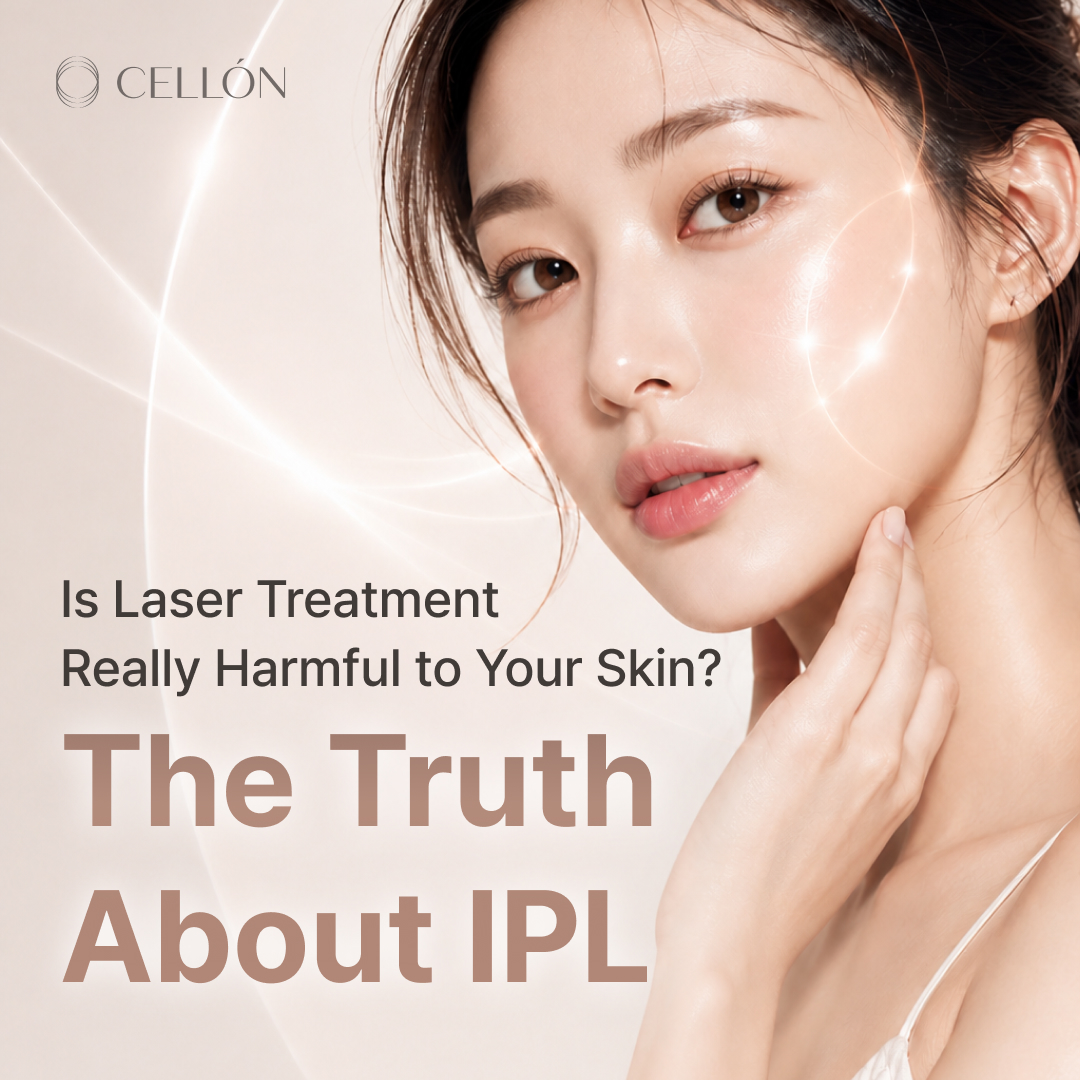 Is Laser Treatment Really Harmful to Your Skin? The Truth About IPL