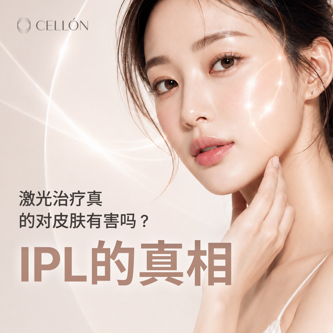 激光治疗真的对皮肤有害吗?IPL的真相