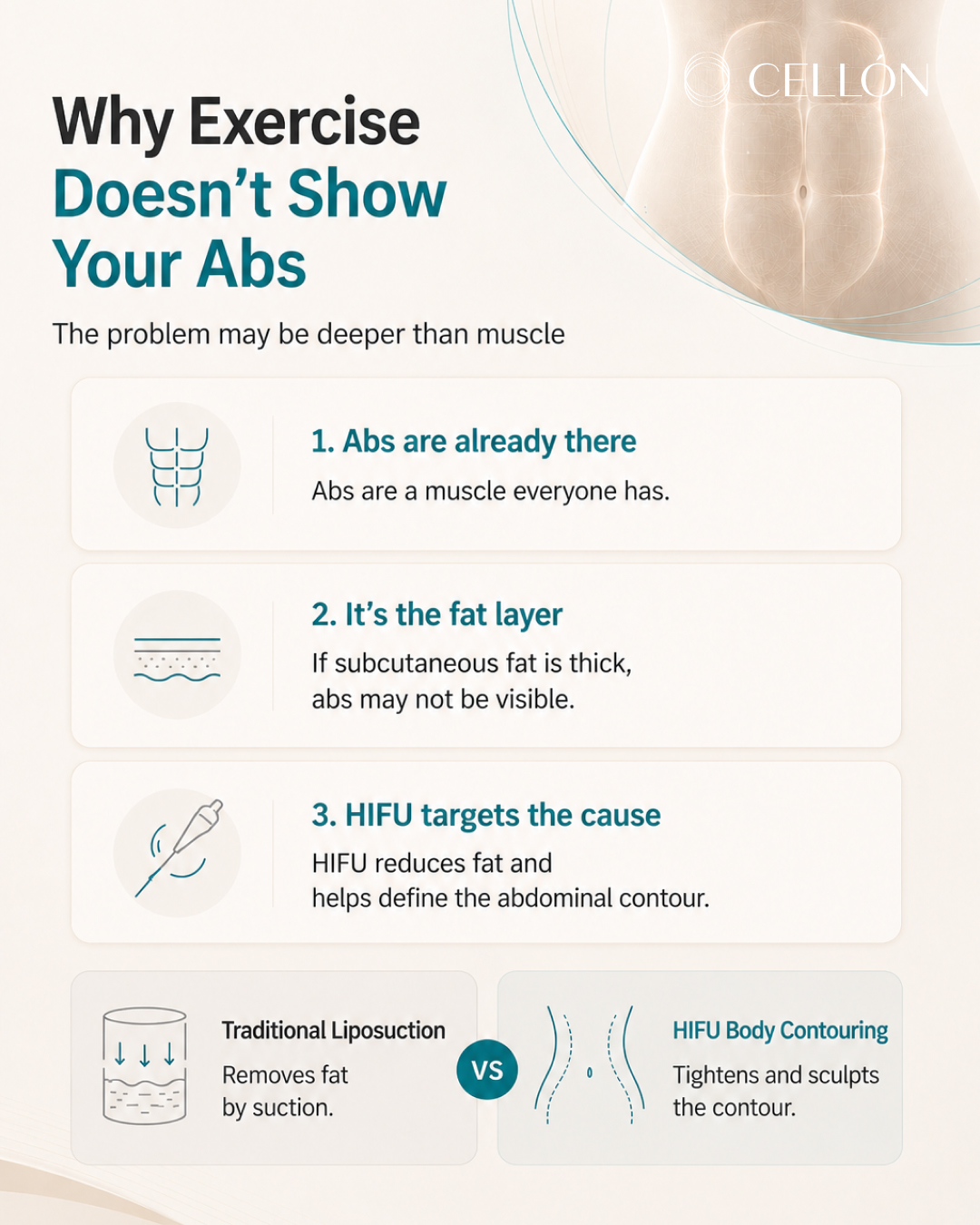 VASER Hi-Def Abdominal Sculpting: Does It Really Work? A Complete Guide