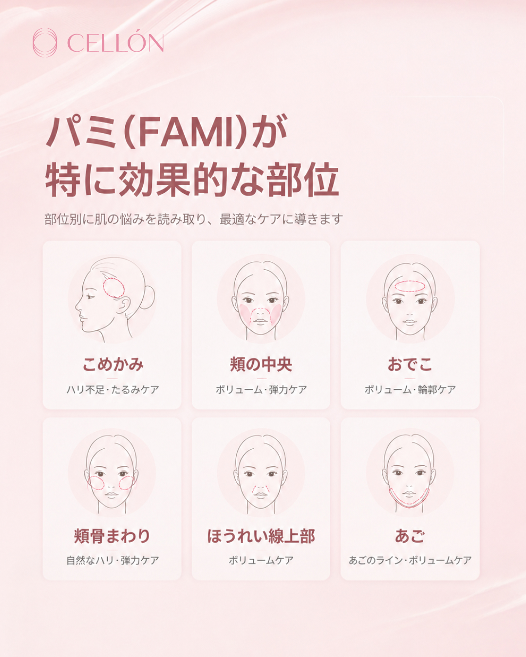 FAMI脂肪移植 部位別アプローチ — 解剖学が結果を左右する理由