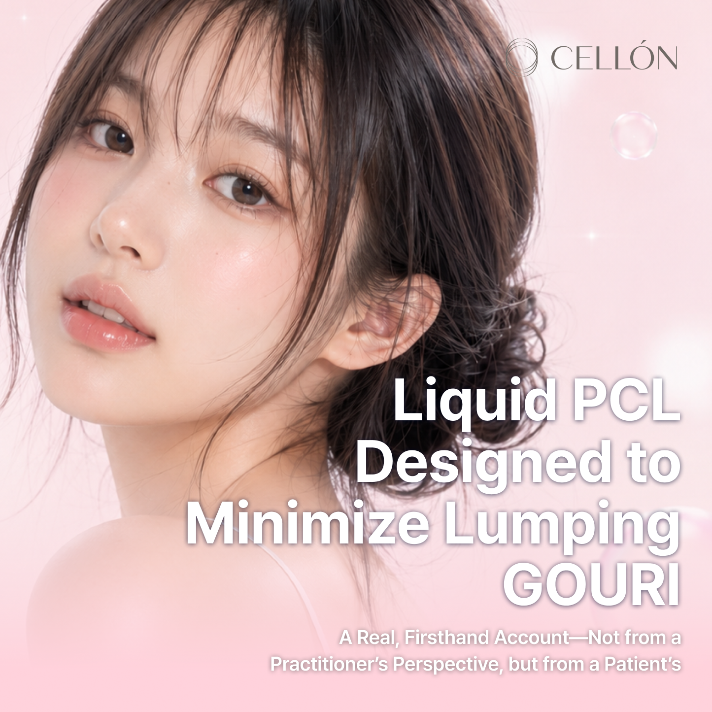 No Lumps, No Fuss: My Honest First-Day Review of GOURI Liquid PCL Injections