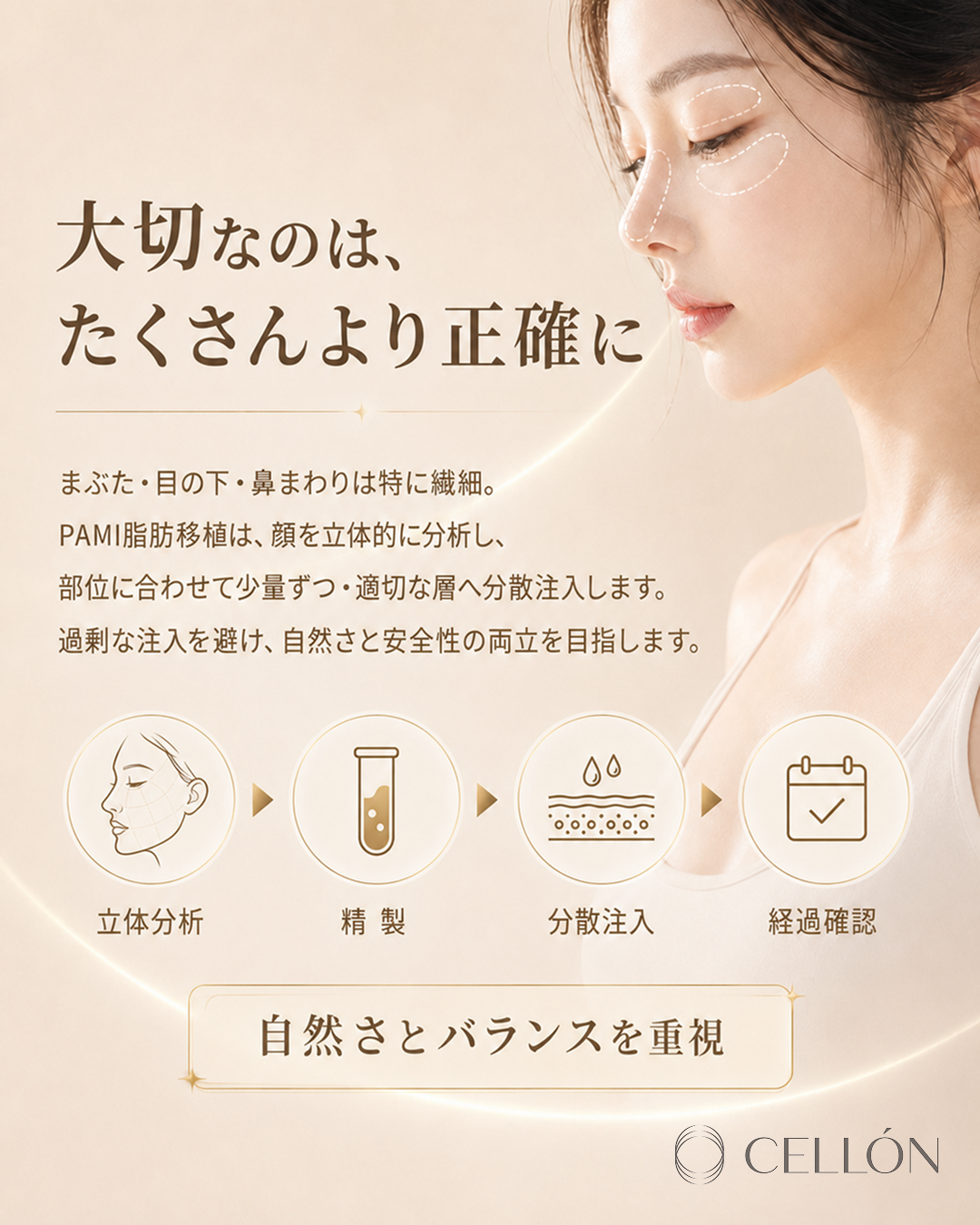 顔の脂肪移植、部位ごとに戦略が異なる理由 — FAMI脂肪移植の視点