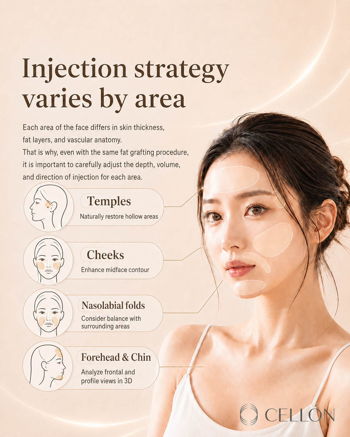 Facial Fat Grafting: Why Every Zone Demands a Different Strategy — The FAMI Approach