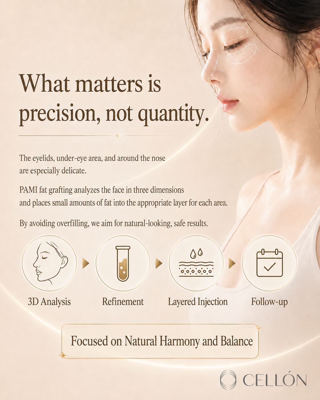 Facial Fat Grafting: Why Every Zone Demands a Different Strategy — The FAMI Approach
