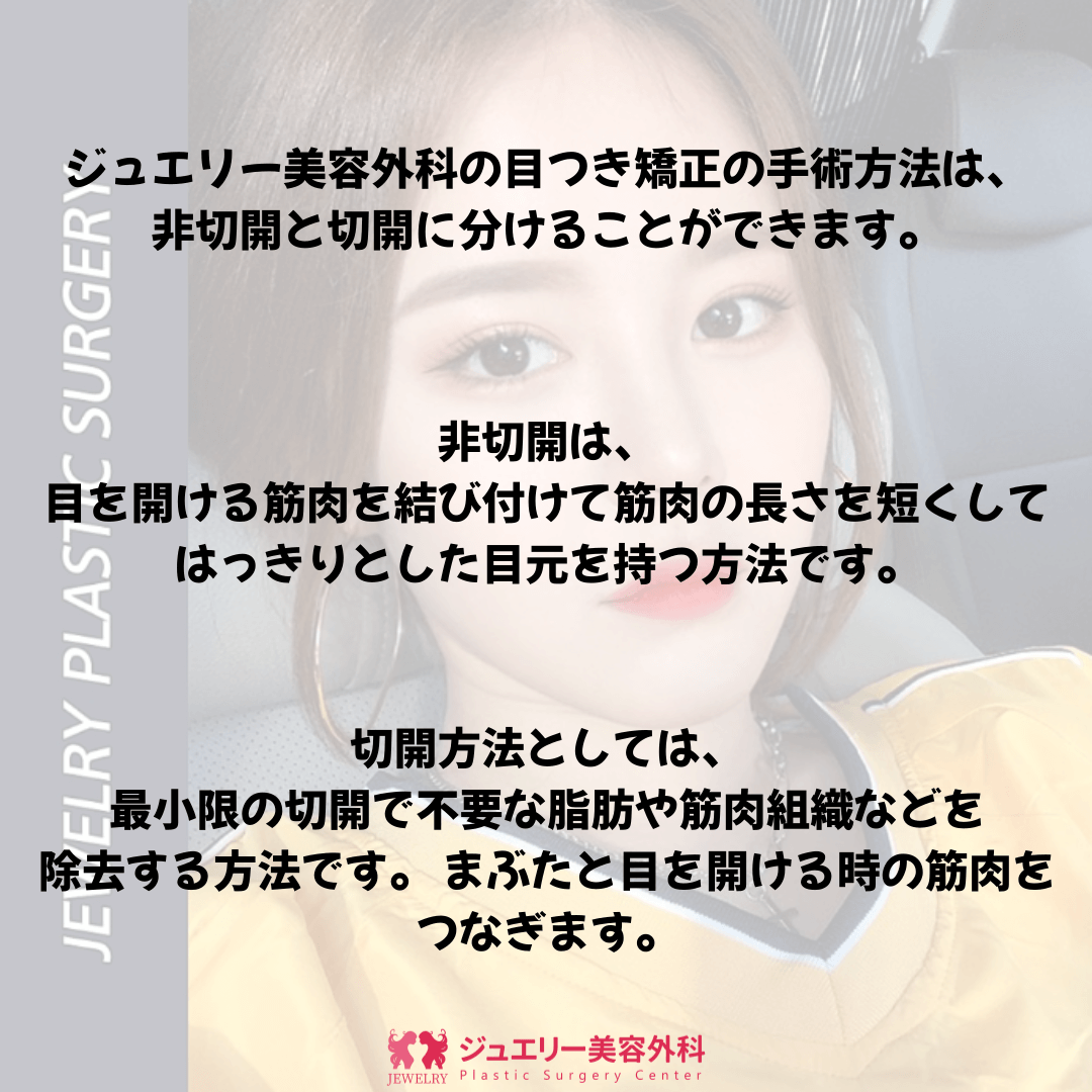 ジュエリー美容外科で目つき矯正方法として、切開法と非切開法の案内