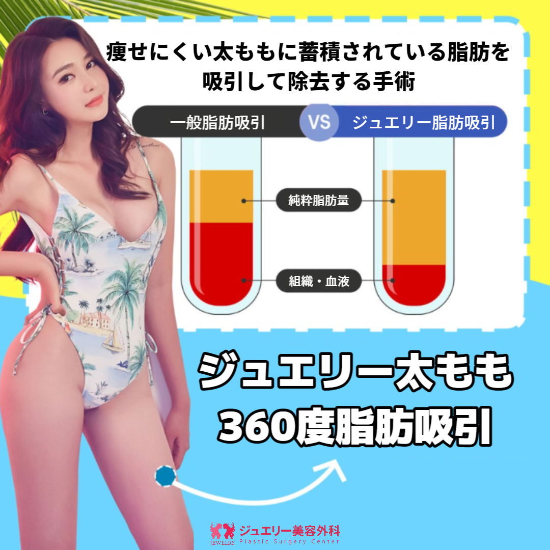 太ももの脂肪吸引とは？