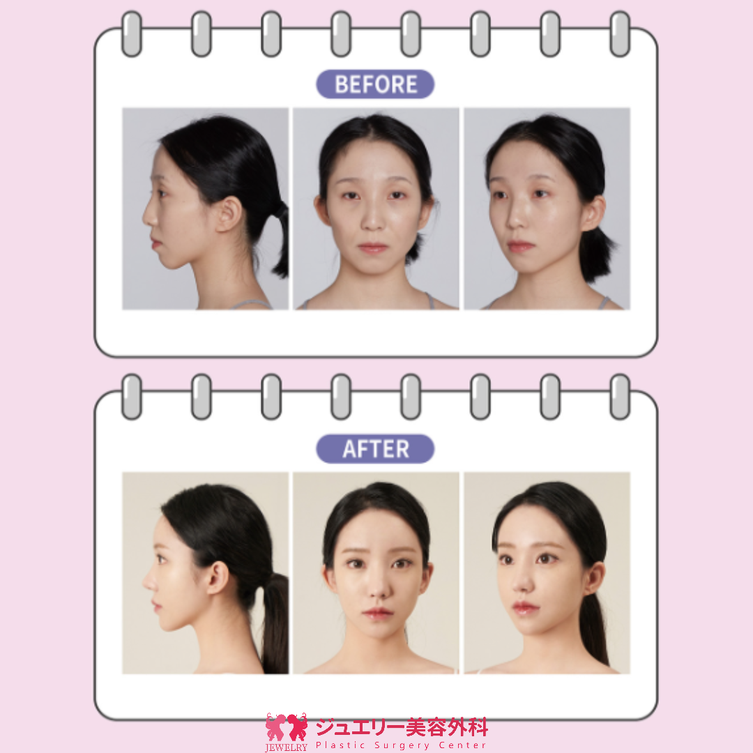 ジュエリー美容外科 リアルストーリー~セボム~004 | ジュエリー美容外科 ジュエリー美容外科 リアルストーリー~セボム~