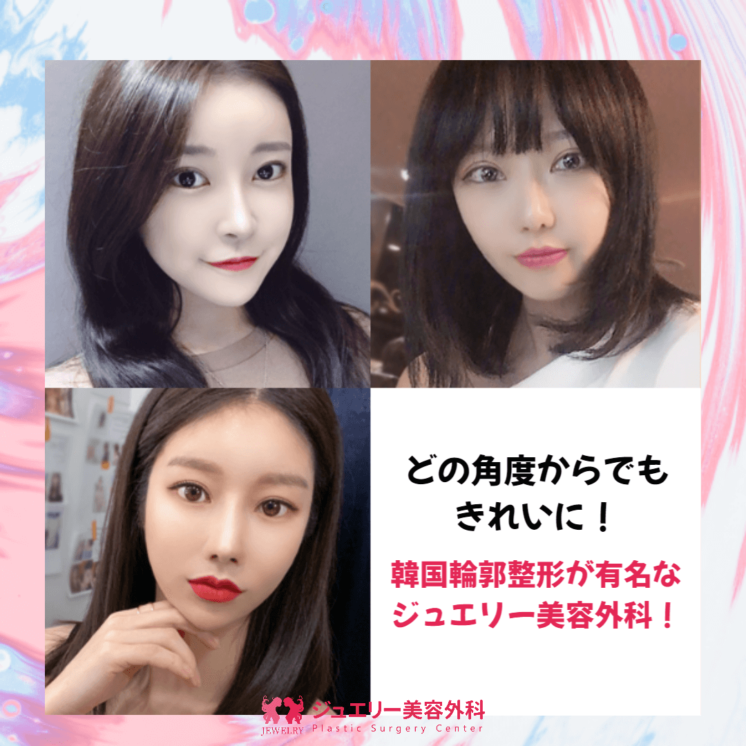 どの角度からでもきれいに！ 韓国輪郭整形が有名な ジュエリー美容外科！