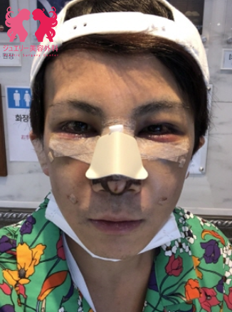 ジュエリー美容外科+韓国男性美容手術+韓国整形+韓国整形外科 | ジュエリー美容外科