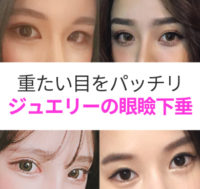 目の整形でも眼瞼下垂を改善が！？ジュエリーの目つき矯正