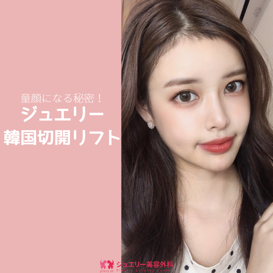 ジュエリー美容外科 童顔になる秘密！ジュエリー韓国切開リフト