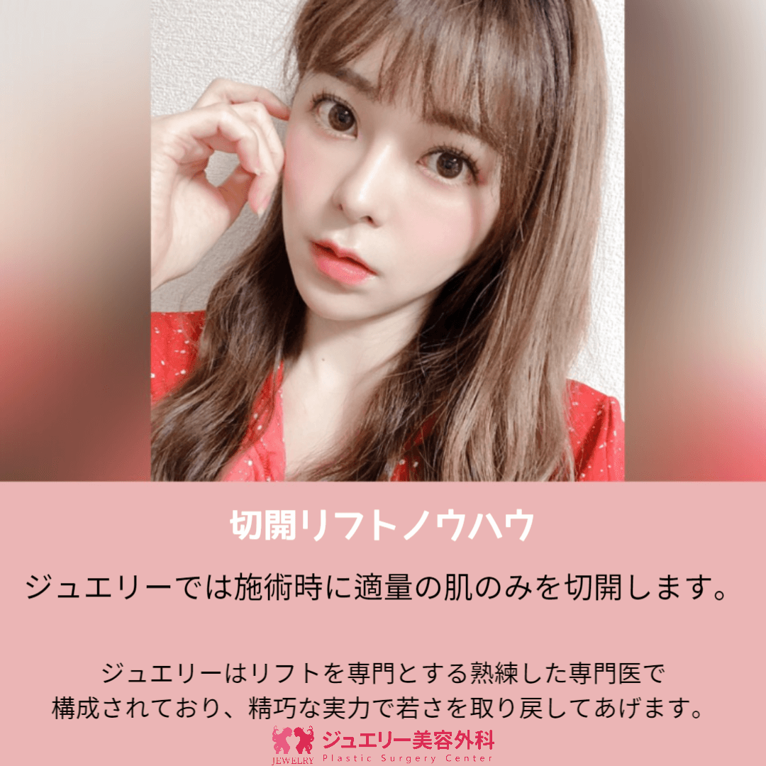 童顔になる秘訣 ジュエリー切開リフト
