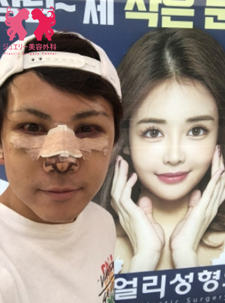 ジュエリー美容外科+韓国男性美容手術+韓国整形+韓国整形外科 | ジュエリー美容外科