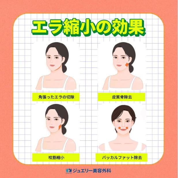 韓国顔面輪郭2点