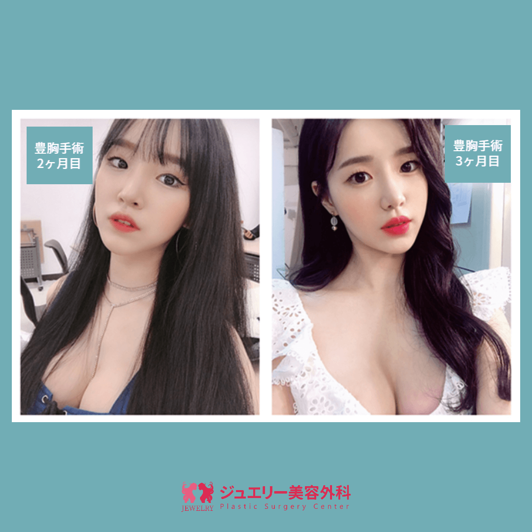 ジュエリー美容外科症例写真