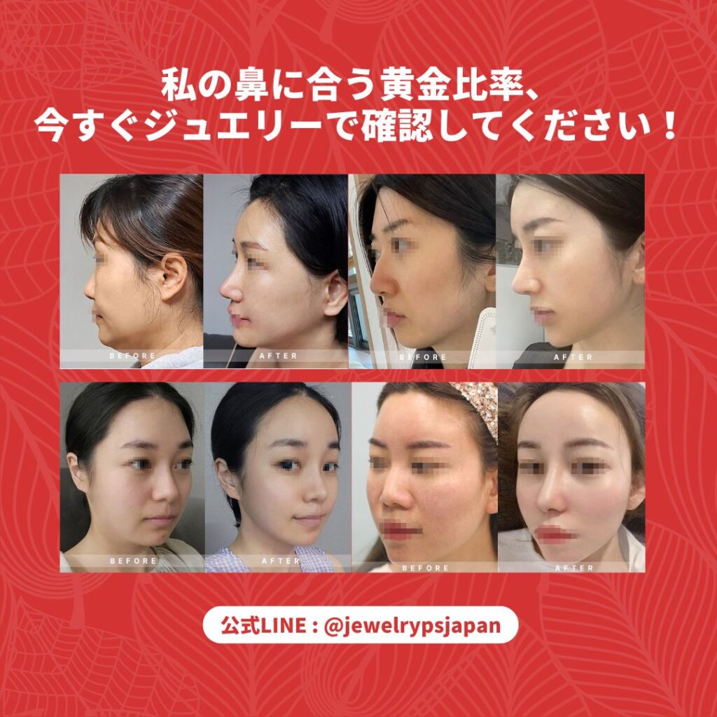 「私の鼻に合う黄金比率、今すぐジュエリーで確認してください！」という見出しの下に、4名の女性の鼻整形ビフォーアフター比較写真が並んでいる。横顔や斜めからのアングルで、鼻筋が通り鼻先が整った変化が示されている。下部には公式LINE「@jewelrypsjapan」の案内がある。