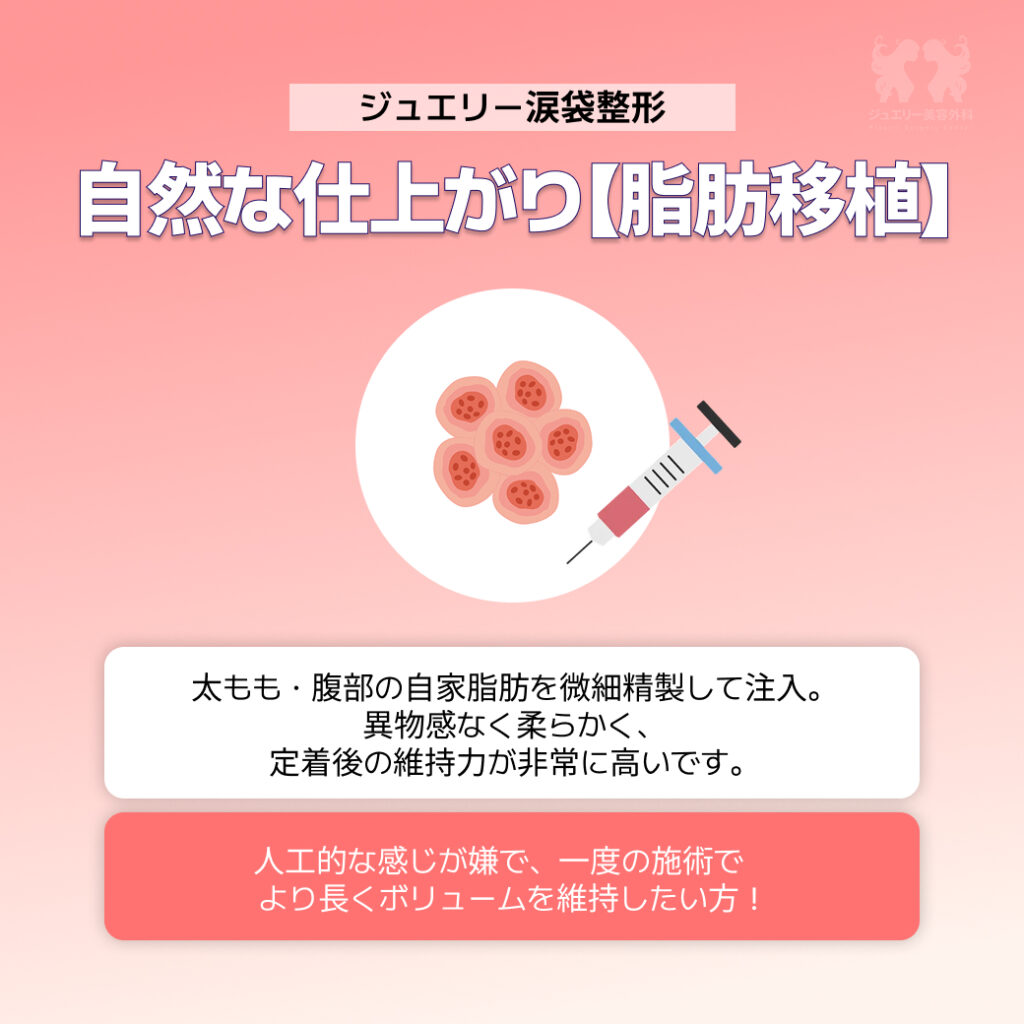 脂肪移植涙袋+フィラー涙袋+外科的涙袋形成術+ジュエリー美容外科-1 | ジュエリー美容外科 ジュエリー美容外科の「自然な仕上がり【脂肪移植】」の解説画像。中央に脂肪細胞と注射器のイラストがあります。説明文には「太もも・腹部の自家脂肪を微細精製して注入。異物感なく柔らかく、定着後の維持力が非常に高いです」とあり、下の赤いボックスには「人工的な感じが嫌で、一度の施術でより長くボリュームを維持したい方!」とおすすめの対象者が記載されています。