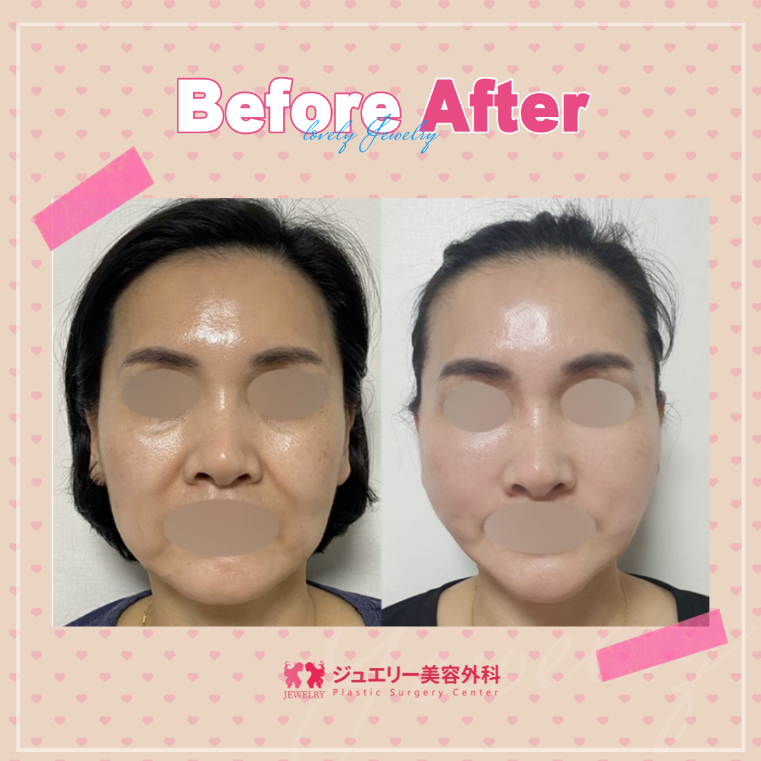 あの時の青春をジュエリーと取り戻す | リアルストーリー