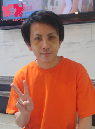 ジュエリー美容外科+韓国男性美容手術+韓国整形+韓国整形外科 | ジュエリー美容外科