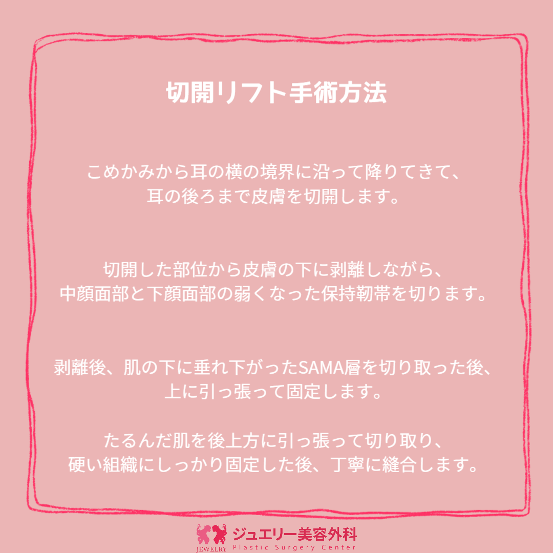 童顔になる秘訣 ジュエリー切開リフト