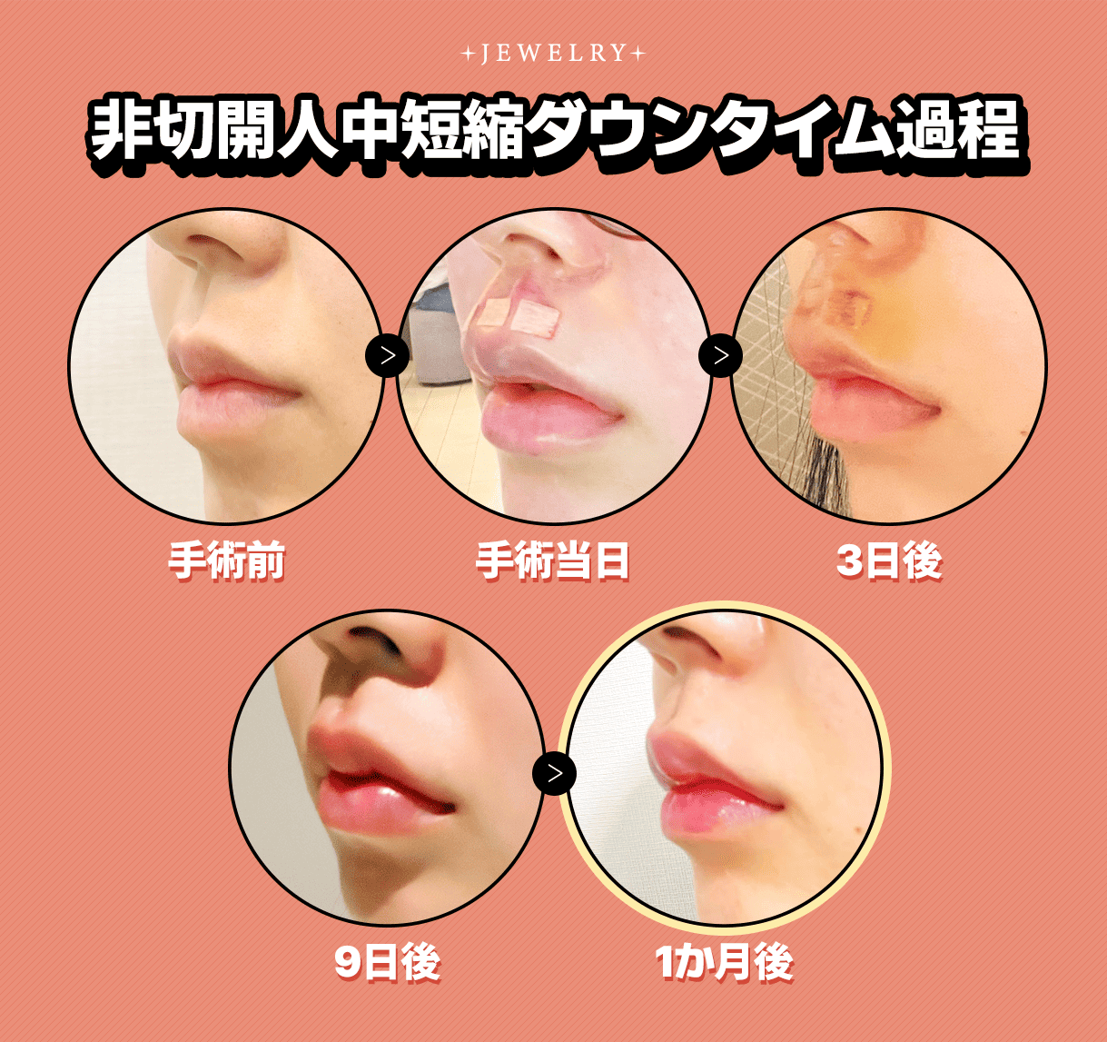 전후 스토리 | ジュエリー美容外科