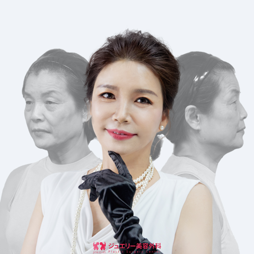 童顔になる秘密!ジュエリー韓国切開リフト007 | ジュエリー美容外科 韓国切開リフト