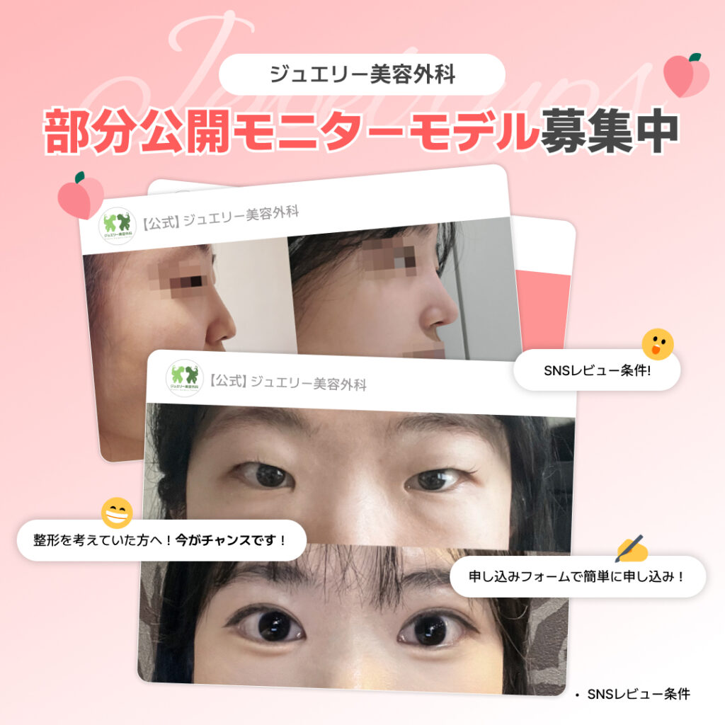 ジュエリー美容外科の部分公開モニターモデル募集の告知画像。目や鼻のパーツごとのビフォーアフター症例写真が複数掲載されている。「部分公開」というタイトルと共に、「SNSレビュー条件！」「整形を考えていた方へ！今がチャンスです！」「申し込みフォームで簡単に申し込み！」という案内メッセージが添えられている。
